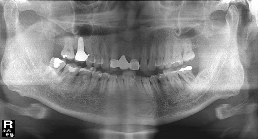 %_tempFileNameImplant%2048i4%