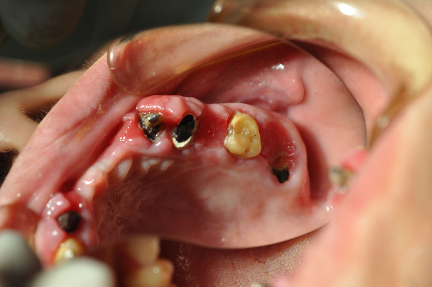 %_tempFileNameImplant%2053a3%