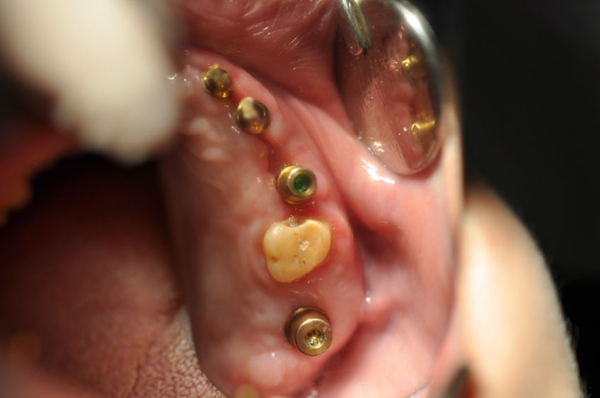 %_tempFileNameImplant%2053d2%