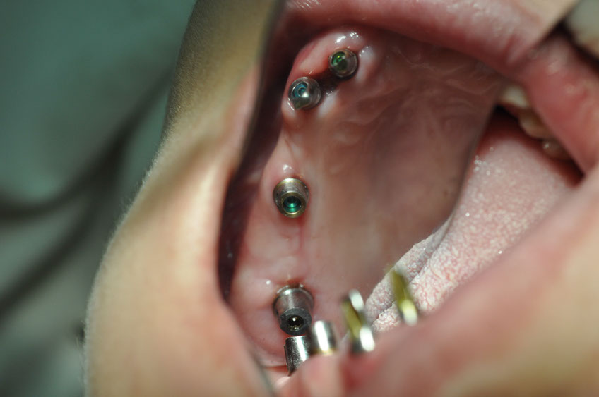 %_tempFileNameImplant%2053d3%