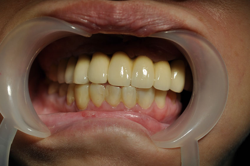 %_tempFileNameImplant%2053f1%