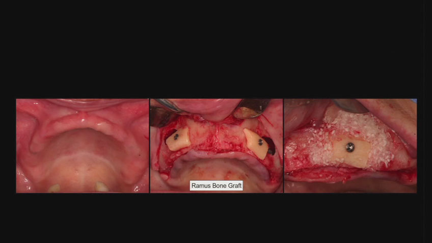 %_tempFileNameImplant%2053h1%