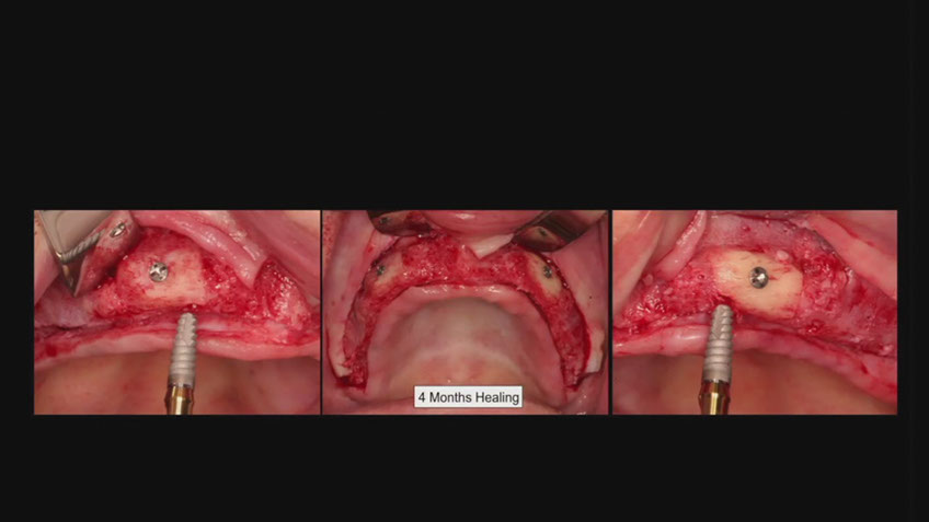 %_tempFileNameImplant%2053h3%