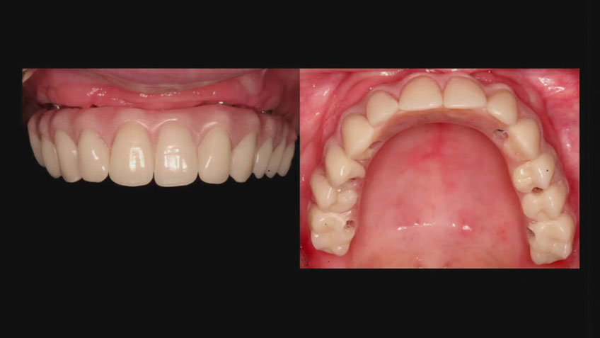%_tempFileNameImplant%2053h5%
