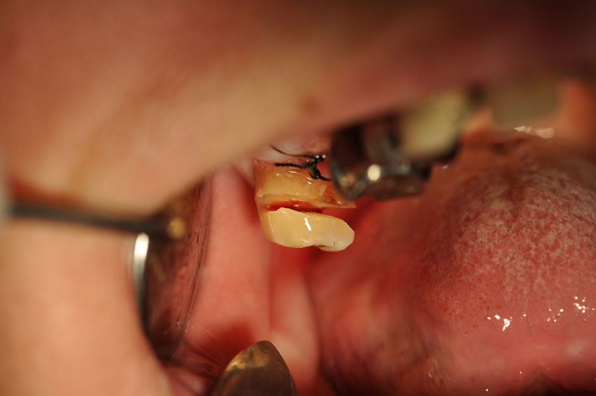 %_tempFileNameImplant%2055b2%