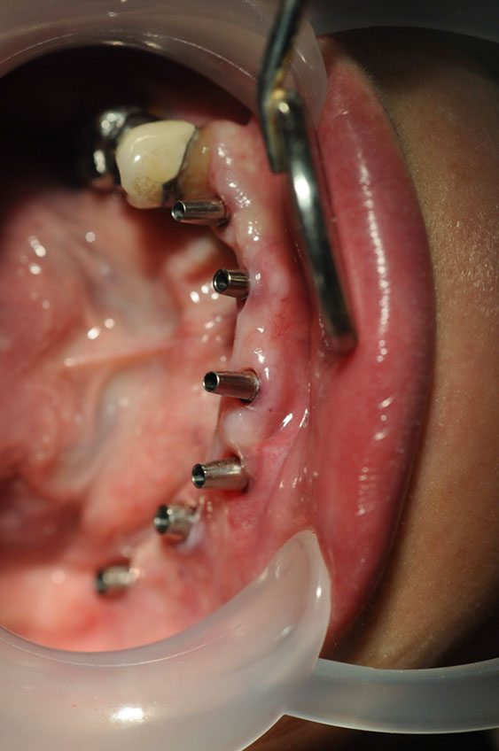 %_tempFileNameImplant%2055b3%