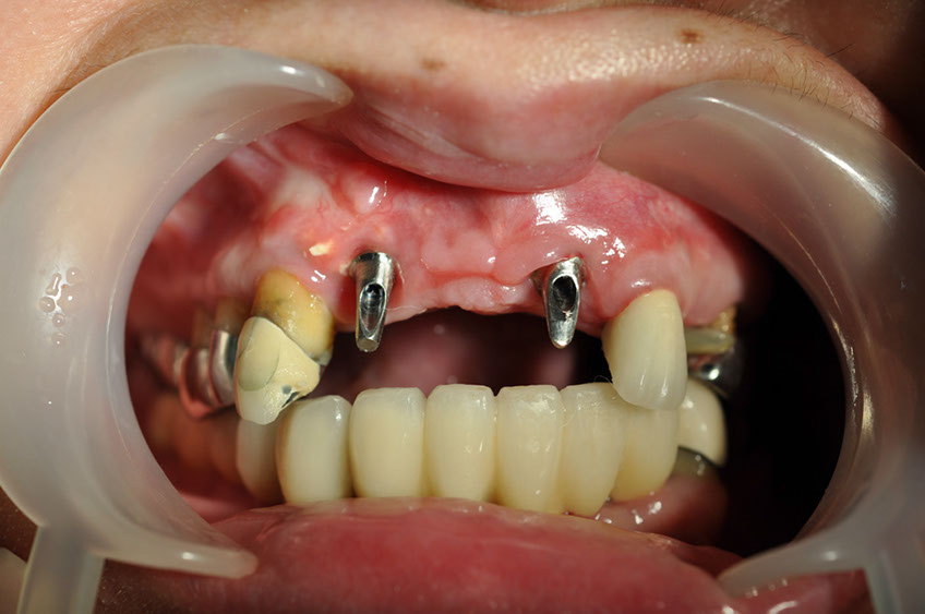 %_tempFileNameImplant%2055b4%