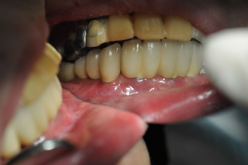 %_tempFileNameImplant%2055c2%
