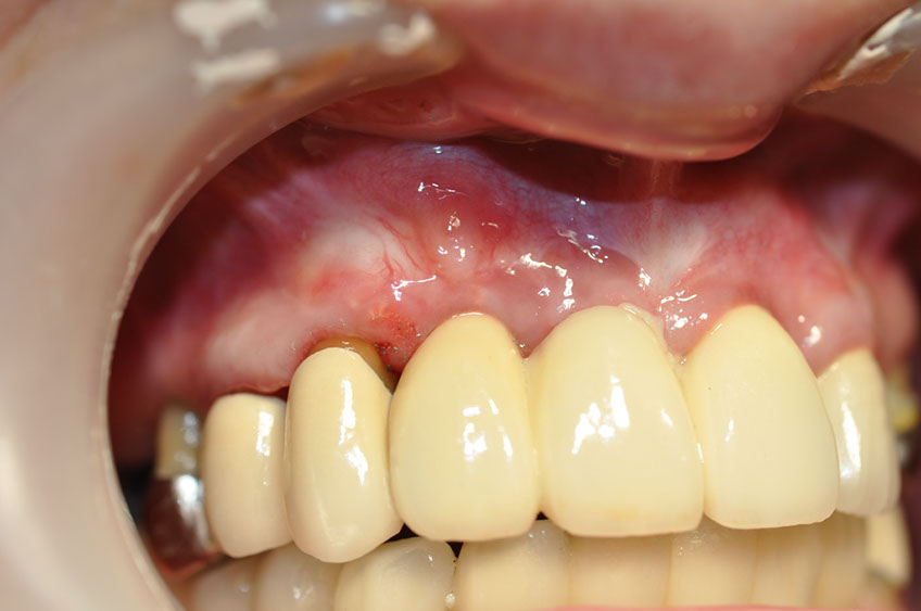 %_tempFileNameImplant%2055d2%