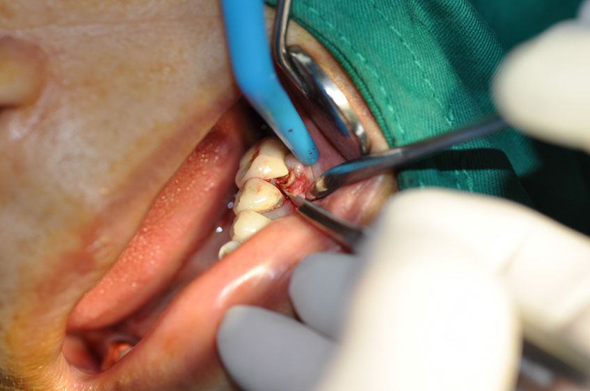 %_tempFileNameImplant%2058a2%