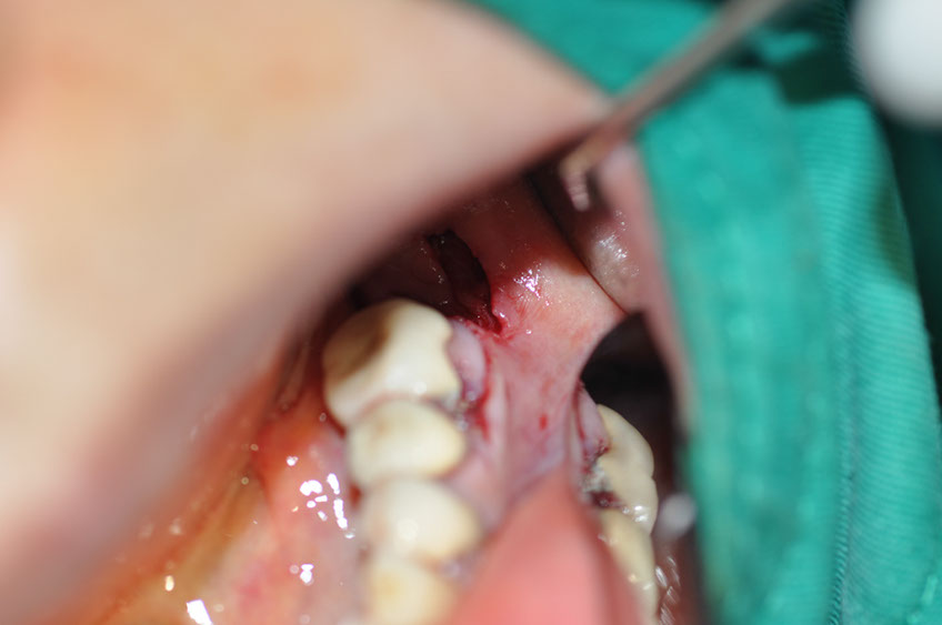 %_tempFileNameImplant%2058b1%