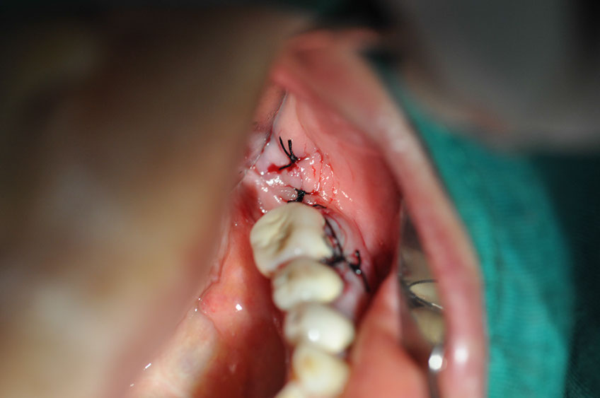 %_tempFileNameImplant%2058b3%