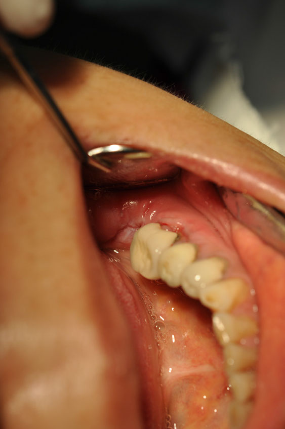 %_tempFileNameImplant%2058b4%