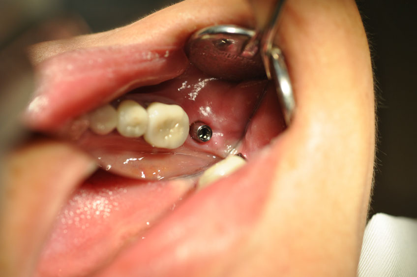 %_tempFileNameImplant%2058c5%