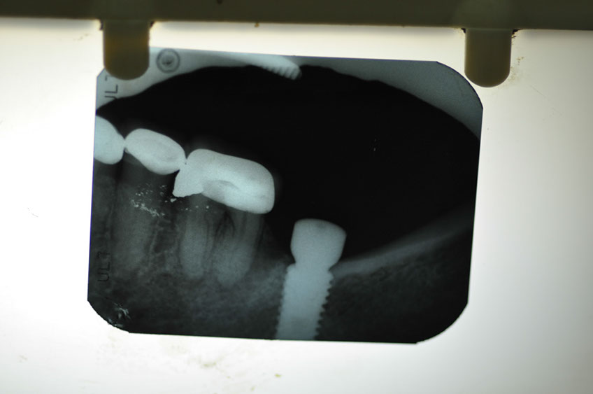 %_tempFileNameImplant%2058e1%