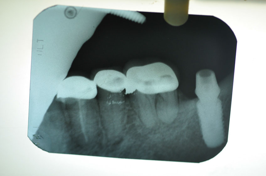 %_tempFileNameImplant%2058e2%