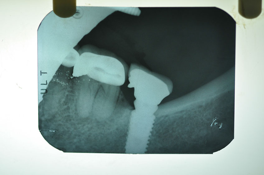 %_tempFileNameImplant%2058e3%
