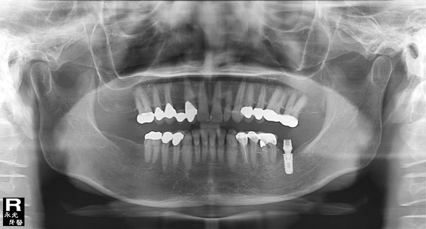 %_tempFileNameImplant%2058f4%
