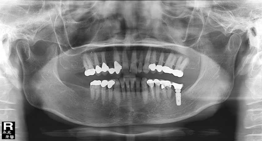 %_tempFileNameImplant%2058f5%