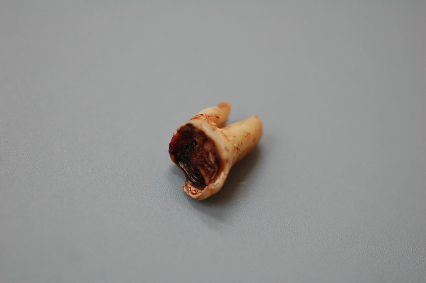 %_tempFileNameImplant%205f1%