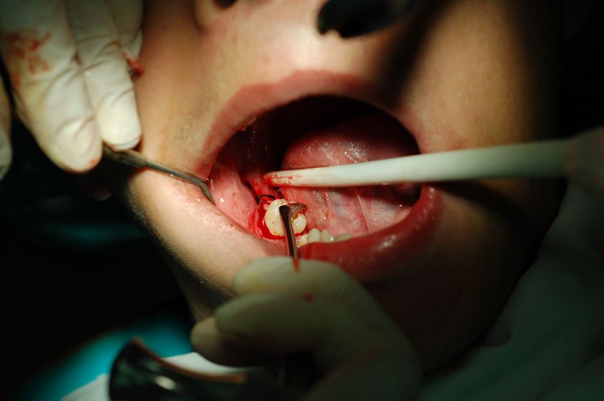 %_tempFileNameImplant%205g%