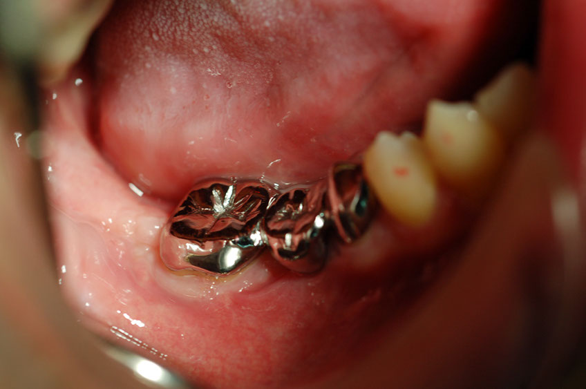 %_tempFileNameImplant%205t1%