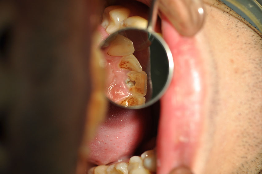 %_tempFileNameImplant%2061a2%