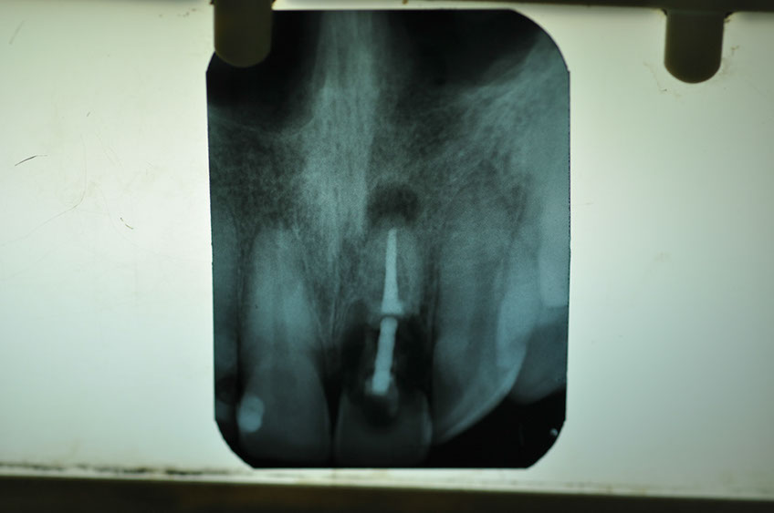 %_tempFileNameImplant%2061a3%