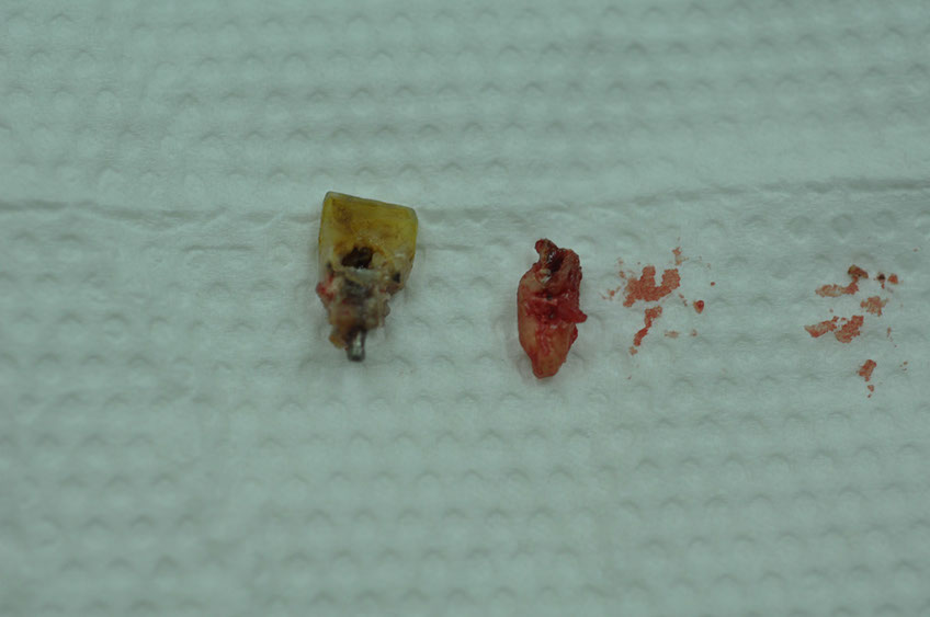 %_tempFileNameImplant%2061a4%