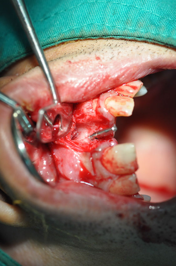 %_tempFileNameImplant%2061b2%