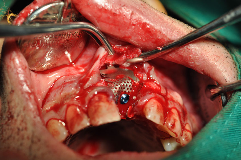 %_tempFileNameImplant%2061b6%