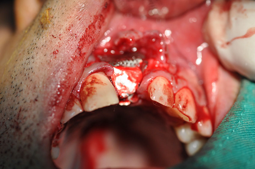 %_tempFileNameImplant%2061b7%