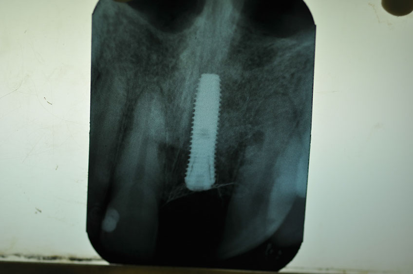 %_tempFileNameImplant%2061b8%