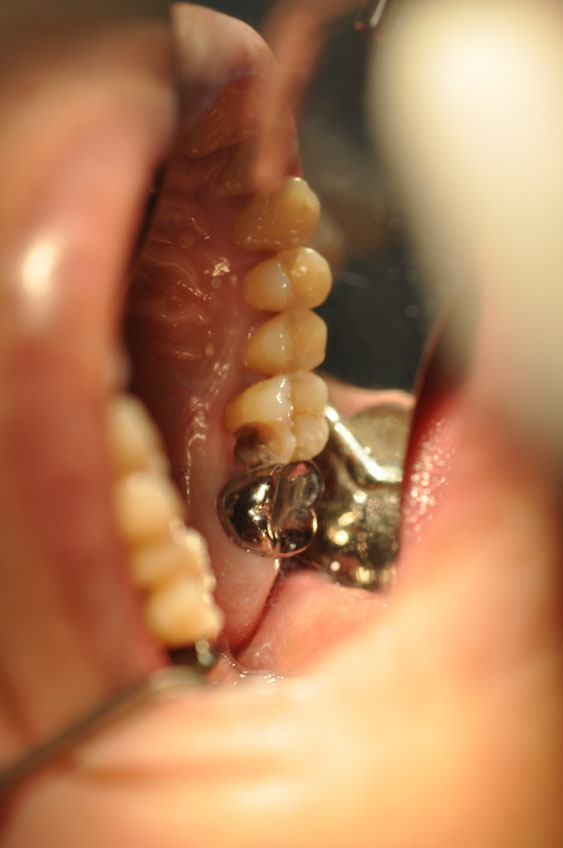 %_tempFileNameImplant%2064a1%