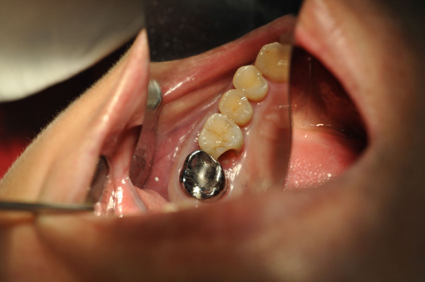 %_tempFileNameImplant%2064a2%