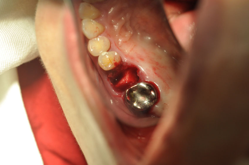 %_tempFileNameImplant%2064a3%
