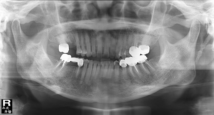 %_tempFileNameImplant%2064d1%