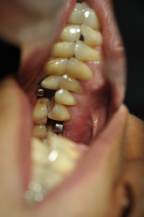 %_tempFileNameImplant%2065b1%