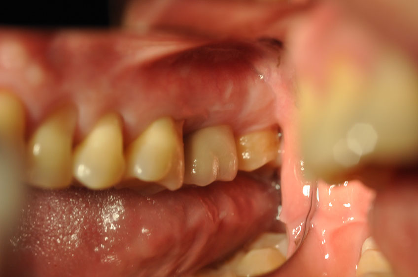 %_tempFileNameImplant%2065b2%