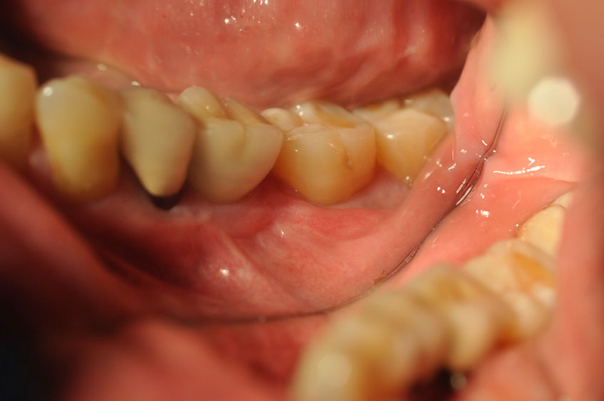 %_tempFileNameImplant%2065b3%