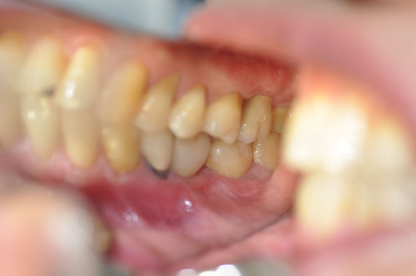 %_tempFileNameImplant%2065c2%