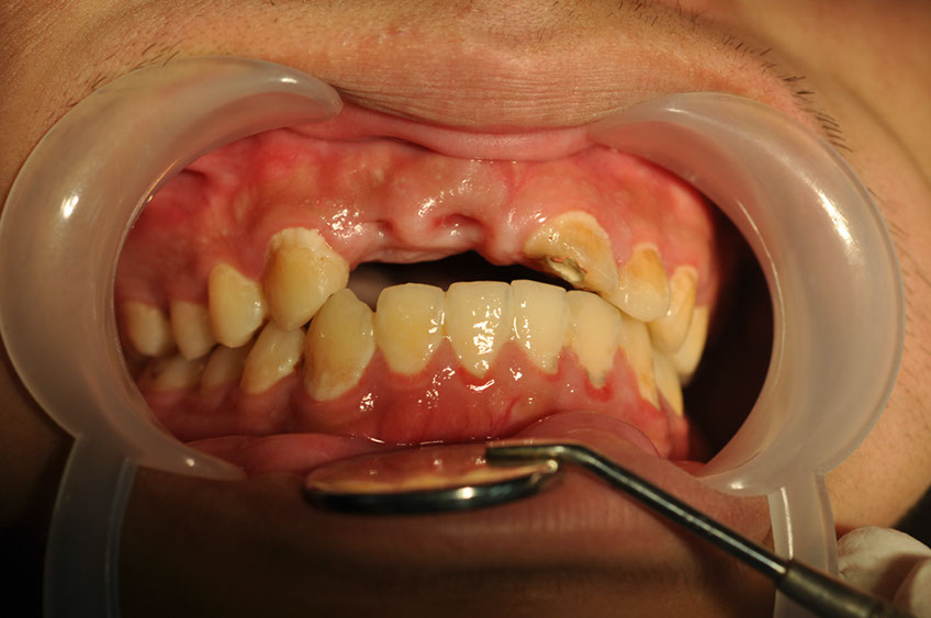 %_tempFileNameImplant%2066a1%