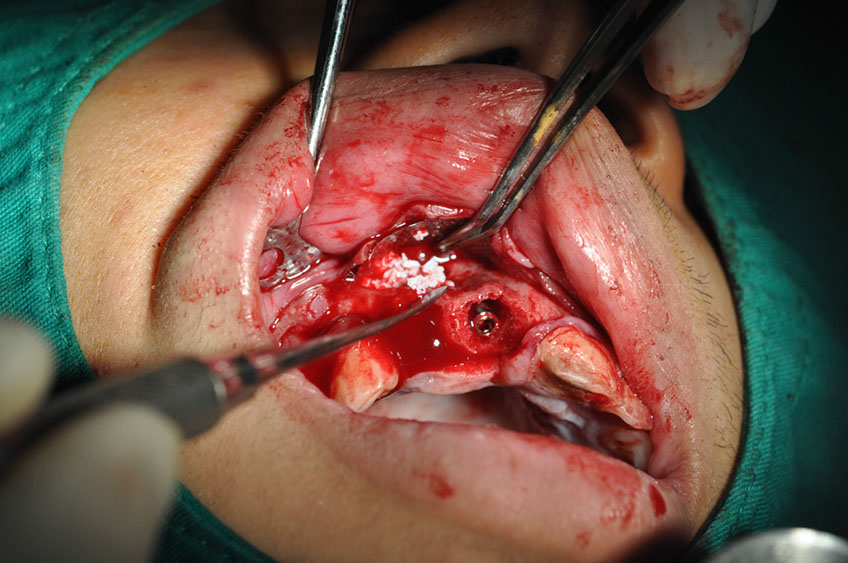 %_tempFileNameImplant%2066a4%