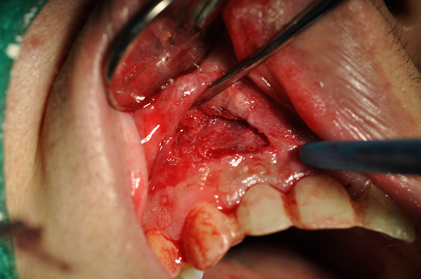 %_tempFileNameImplant%2066b2%