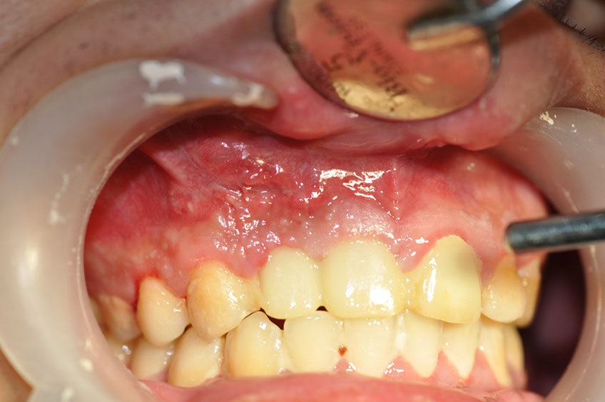 %_tempFileNameImplant%2066b3%