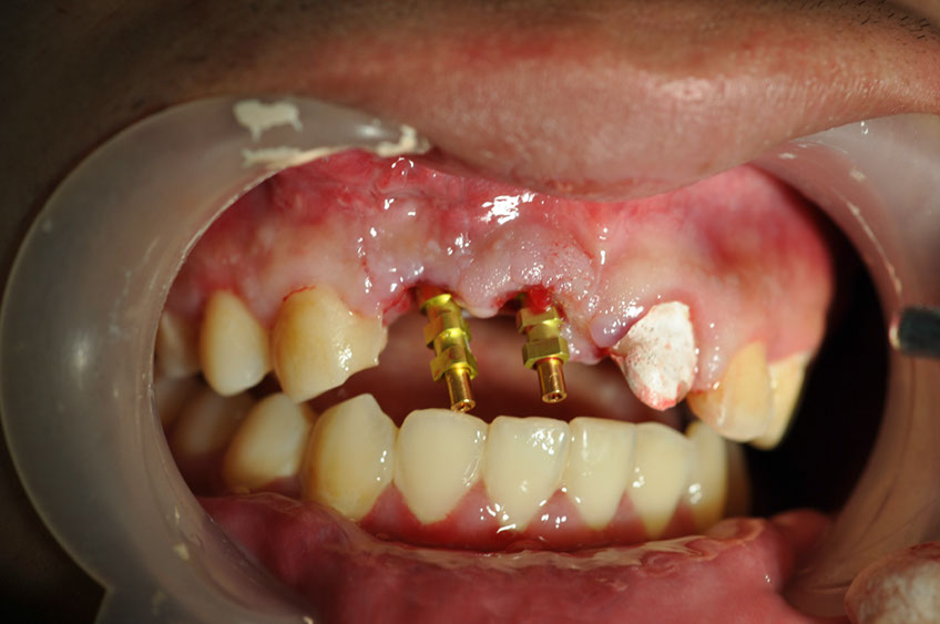 %_tempFileNameImplant%2066b4%