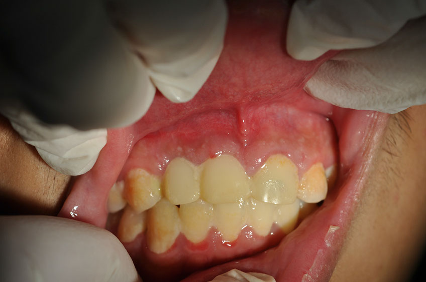 %_tempFileNameImplant%2066b5%