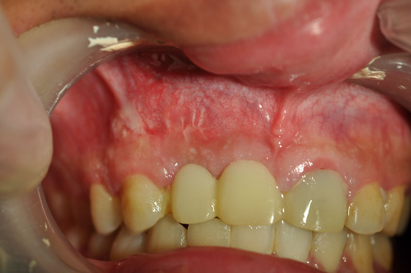 %_tempFileNameImplant%2066b6%