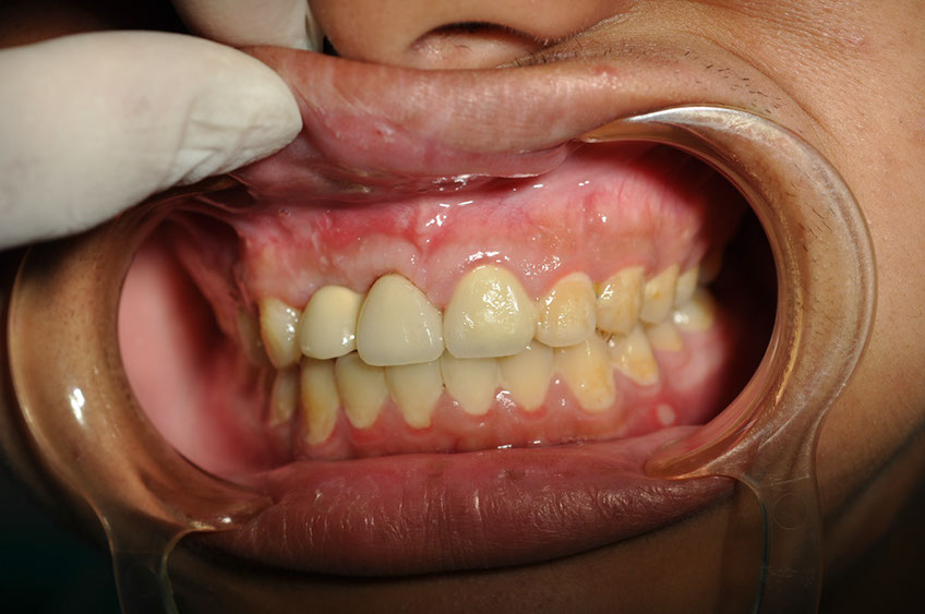 %_tempFileNameImplant%2066c1%