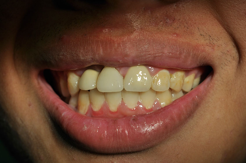 %_tempFileNameImplant%2066c2%